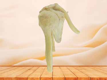 medical teaching specimen