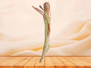mid thight-foot plastination