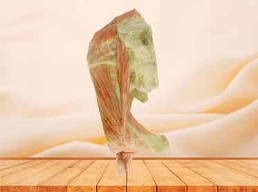 plastinated human