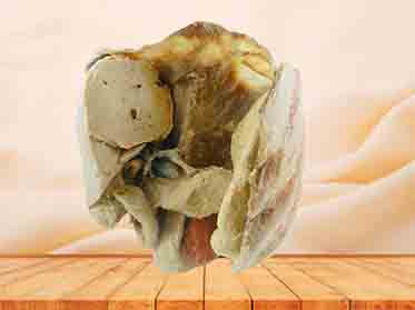 plastinated human model