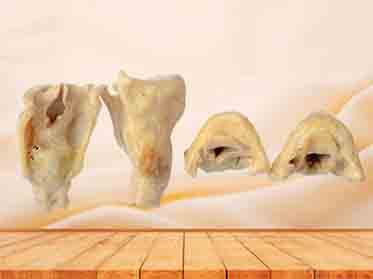 plastinated laryngeal cartilages