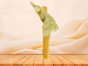 saggital section of knee joint for medical students