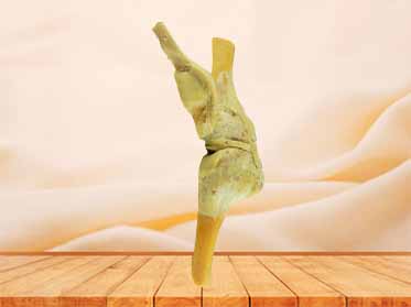 saggital section of knee joint for sale