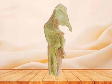 sagittal section of hip joint muscle plastination