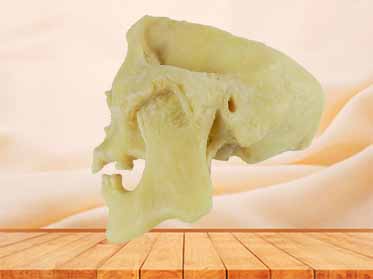 temporal-mandibular joint