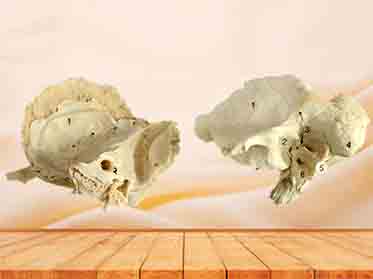temporal bone specimen