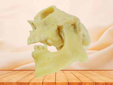 temporomandibular articulation