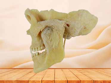 temporomandibular articulation specimen