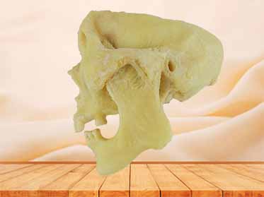 temporomandibular joint plastinated specimen