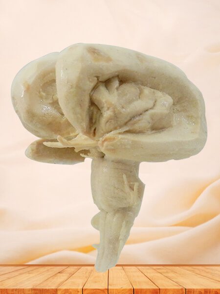 Brain stem