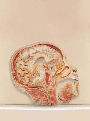 Sagittal Section of Head Plastinated Specimen 