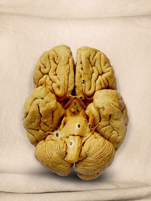 Whole Brain Plastinated Specimen