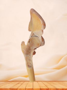 Coronal section of hip joint plastinated specimen