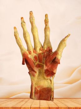 Deep muscles of hand plastinated specimen