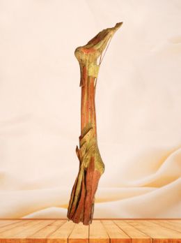 Deep muscles of lower limb plastinated specimen