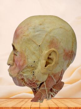 Facial nerve plastinated specimen