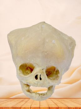 Fontanelle of infant plastinated specimen