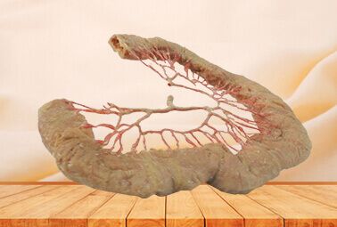 Jejunum vascular arch