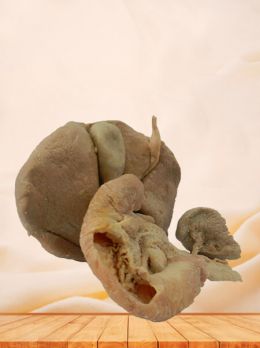 Liver pancreas duodenum spleen plastinated specimen