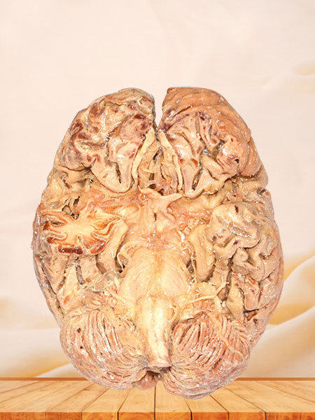 Arteries of base of brain