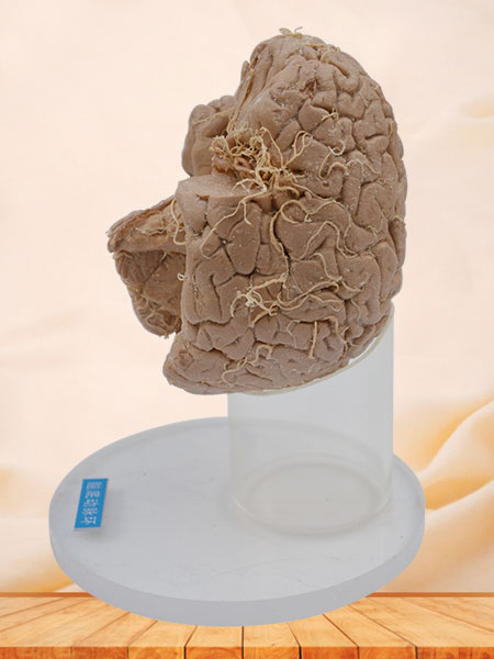 Arteries of base of brain plastinated specimen
