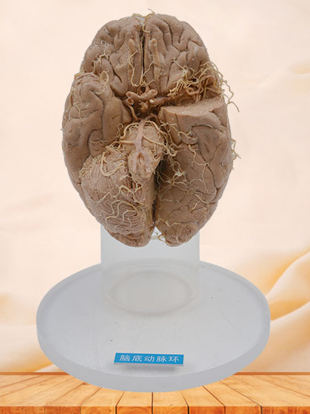 Arteries of base of brain plastination