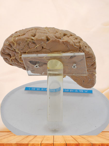 Artery of cerebral hemisphere plastinated specimen