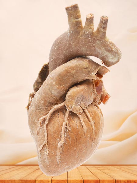 Cardiovascular anatomy specimen