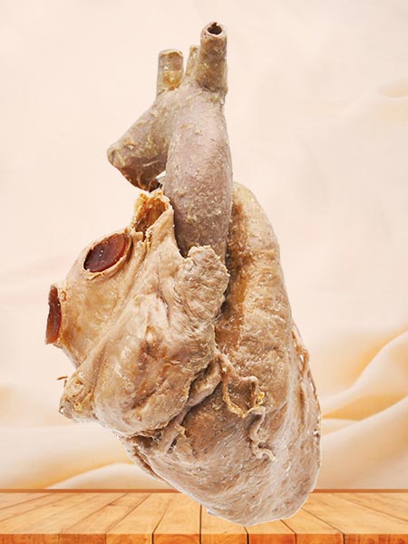 Cardiovascular specimen