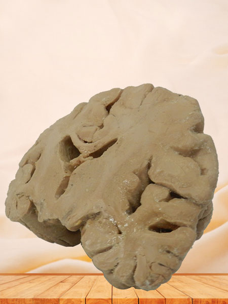 Coronal section of brain plastinated specimen