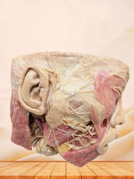 Facial nerve with its branches