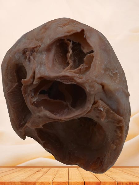 Heart（Heart specimen with ventricles opened to expose the valves）plastinated specimen