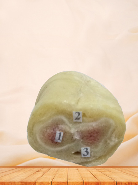 Horizontal section of penis plastination