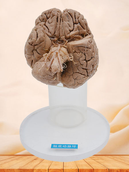 Human arteries of base of brain