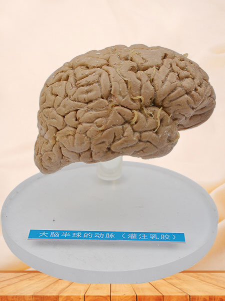 Human artery of cerebral hemisphere