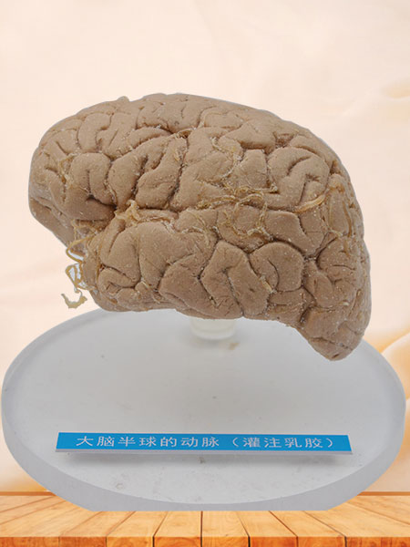 Human artery of cerebral hemisphere plastinated specimen