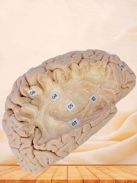 Human association fiber of cerebral hemisphere