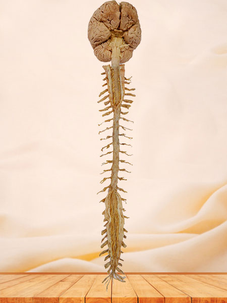 Human brain and spinal cord plastinated specimen