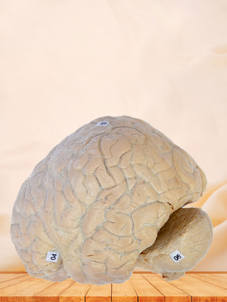 Human cerebral arachnoid mater plastination specimen