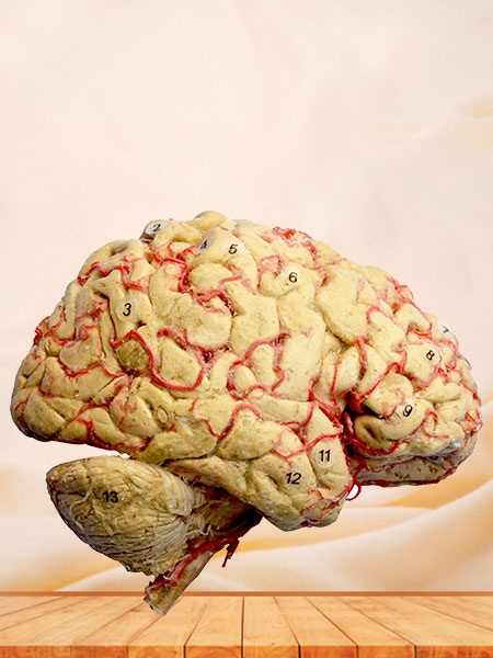 Human cerebral hemisphere and brain stem