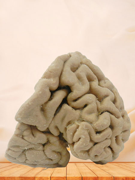 Human coronal section of brain