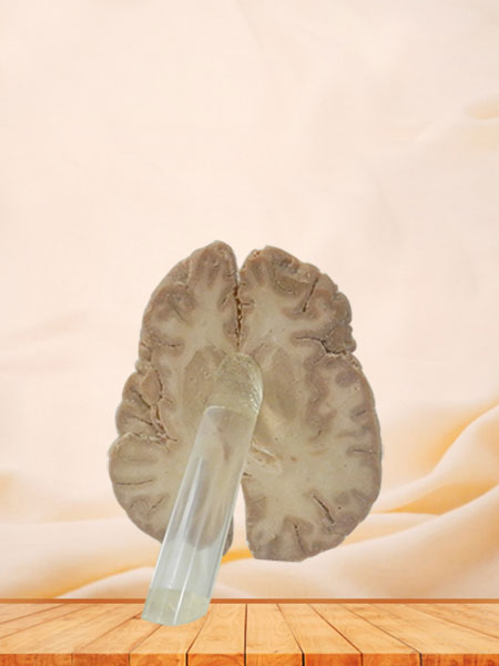 Human horizontal section of brain through inner capsule plastination