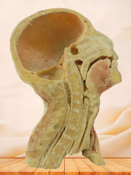 Human superficial vascular nerve of head and neck plastination