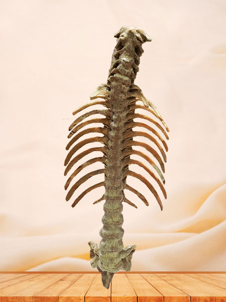 Human vertebral column plastination specimen