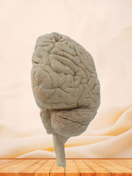 segital section of thebrain segital section of thebrain