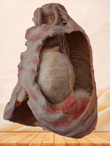 Mediastinal organs and diaphragm
