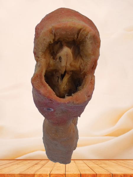 Pharynx and larynx plastinated specimen