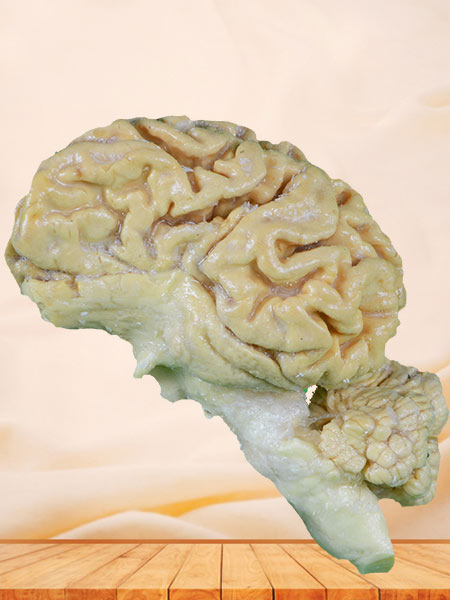 Pig brain hemisphere plastination specimen