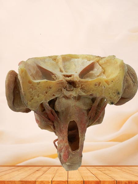 Posterior of pharyngeal muscles anatomy specimen