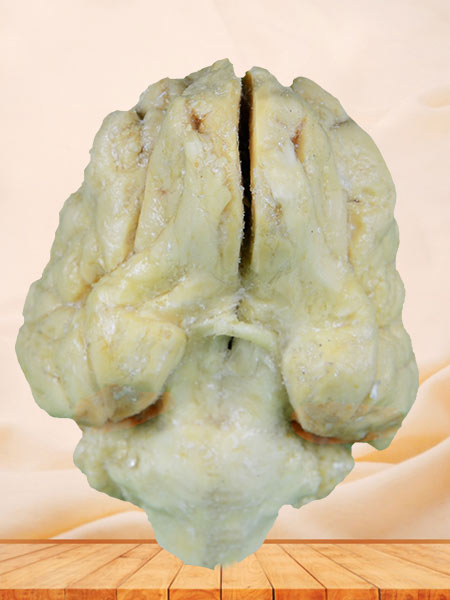 The anatomy of pig brain